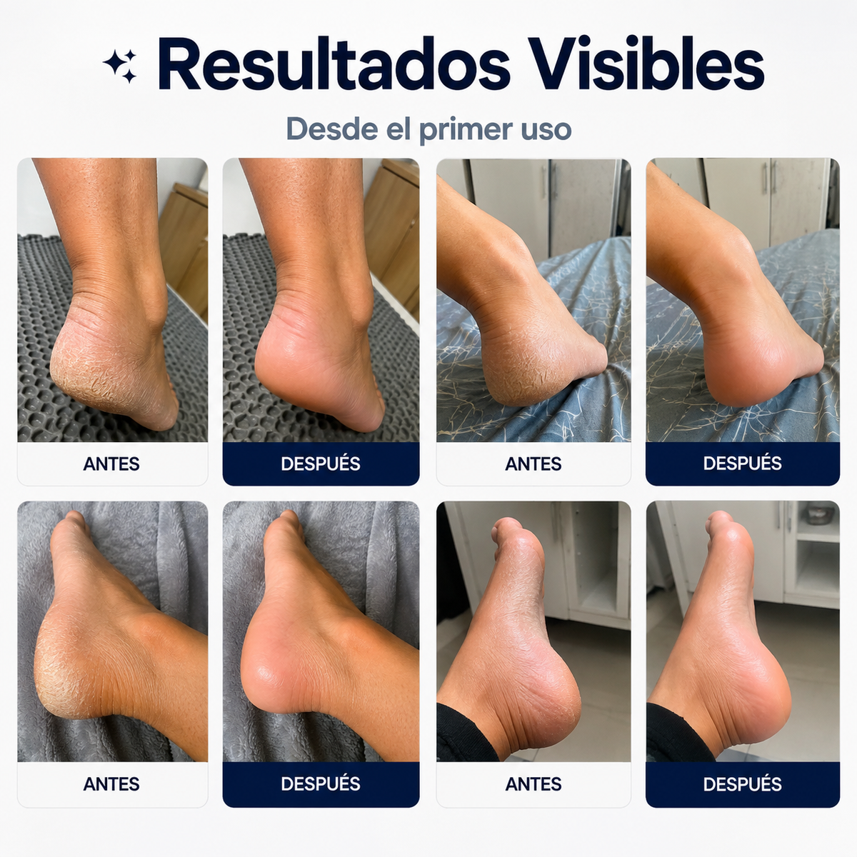 Removedor de Callos™ – Lima Eléctrica para Pies y Durezas